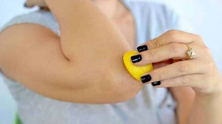 وصفات طبيعية للتخلص من سواد الركب والكوع