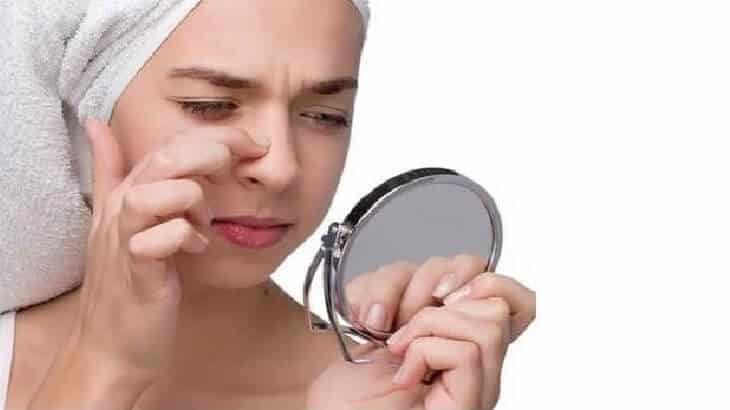 10 وصفات لازالة الرؤوس السوداء نهائياً