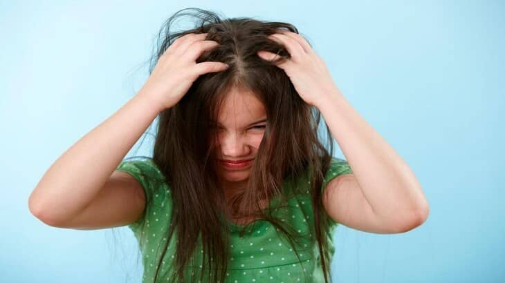 7 وصفات لعلاج القمل والوقاية منه بسهولة.