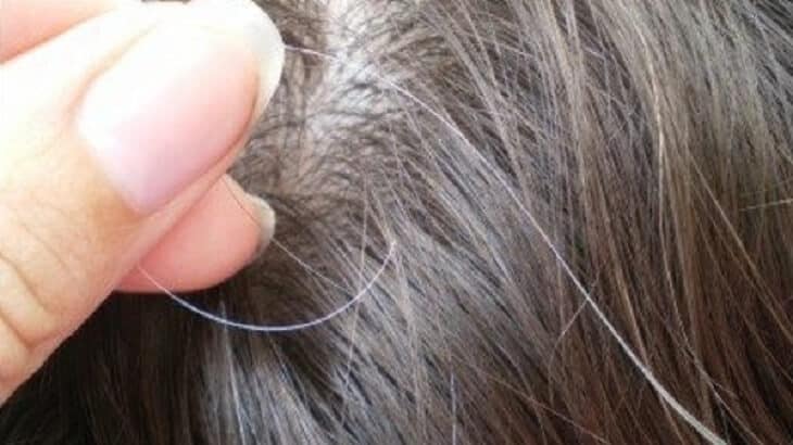 علاج الشعر الابيض المبكر نهائيا للشباب