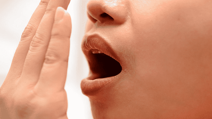 علاج التهاب اللثة الشديد ورائحة الفم الكريه