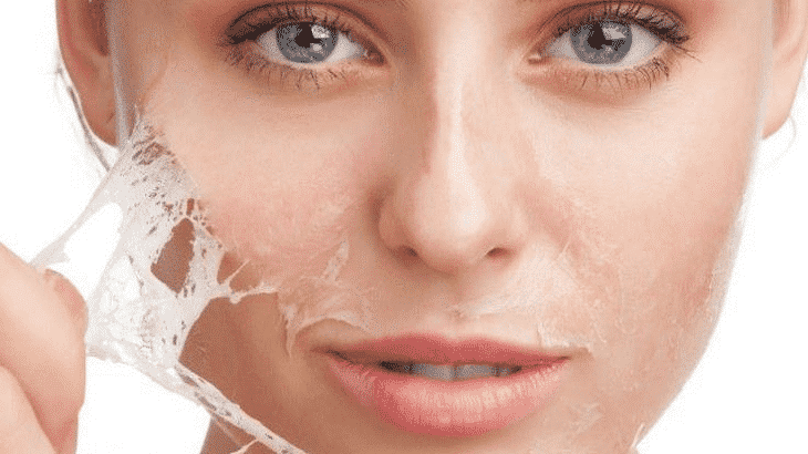 13وصفة طبيعية لعلاج حساسية الوجه نهائيا