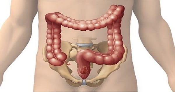 اعراض الديدان عند الكبار والصغار وكيفية علاجها