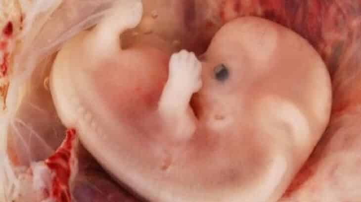 شكل الجنين في الاسبوع الثامن من الحمل ومراحل النمو