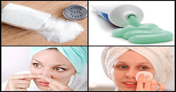 ازالة الرؤوس السوداء طبيعيا من الانف من اول مرة