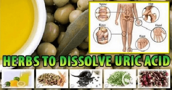 علاج النقرس والأملاح بالأعشاب الطبيعية