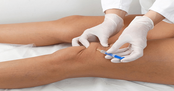 علاج خشونة الركبة والمفاصل بالزيوت الطبيعية