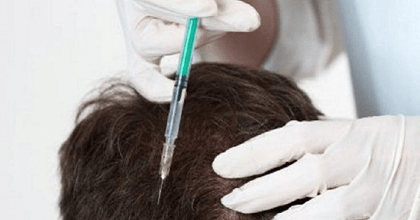 نصائح بعد حقن البلازما للشعر والوجه
