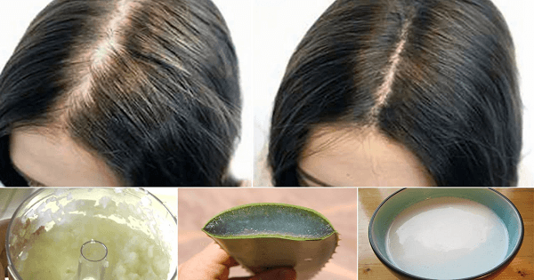 علاج تساقط الشعر الشديد بالاعشاب والقران الكريم