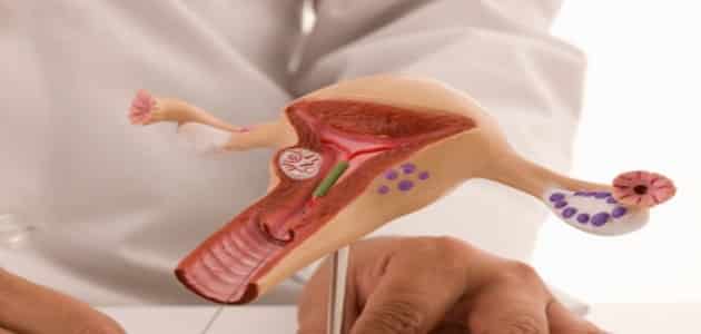 أعشاب لتنظيف الرحم بعد الإجهاض مباشرة