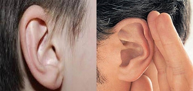 طرق علاج الإعاقة السمعية