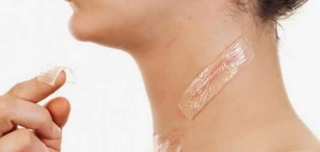 علاج آثار حروق الزيت بالزيتون والدقيق