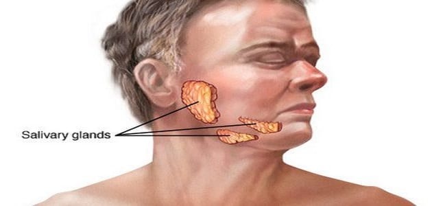 علاج مرض النكاف والعقم