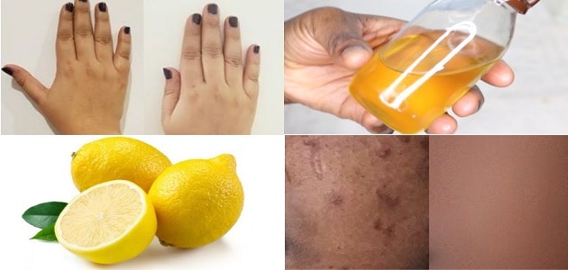 وصفات زيت الليمون للبشرة