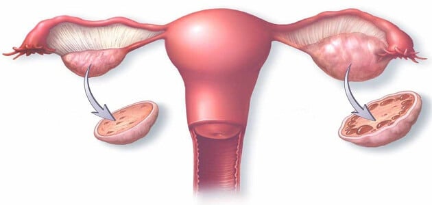 أسباب انقباضات الرحم بدون حمل