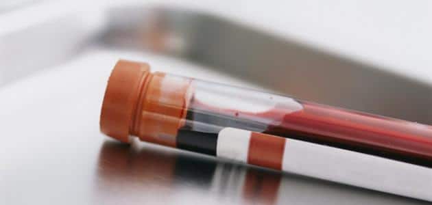 تحليل الدم للحمل، معلومات هامة وأنسب وقت لعمله