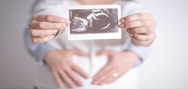 شكل الجنين في الشهر الثالث في بطن أمه + نصائح هامة