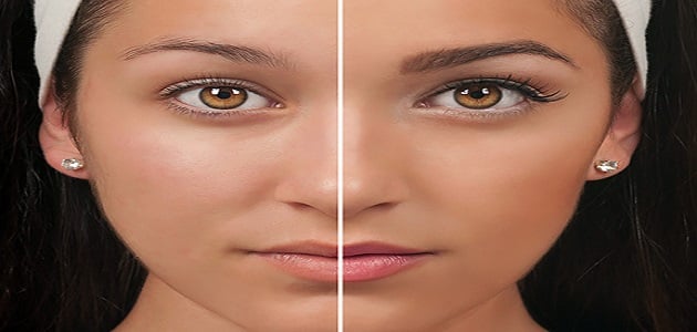 أضرار تشقير الحواجب بالليزر على الجلد
