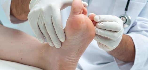 علاج مسمار القدم عند الأطفال