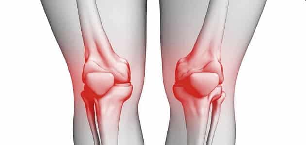 علاج احتكاك الركبة والمشي بالأعشاب الطبيعية