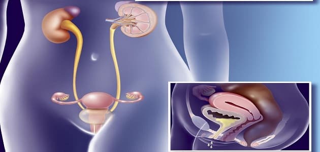علاج تقطير البول بعد التبول عند النساء