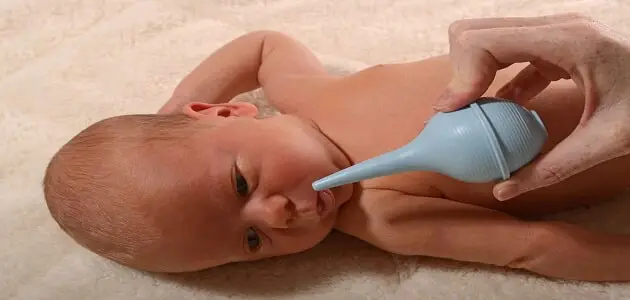 التخلص من الخنفرة عند الرضع