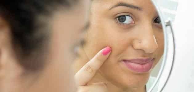 5 فوائد سحرية لاستخدام كريم سكينورين لتصبغات البشرة