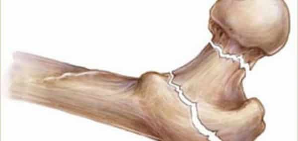 أطعمة ومشروبات