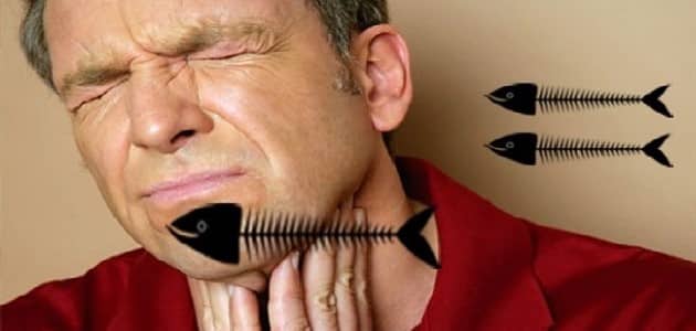 إبتلاع شوك السمك