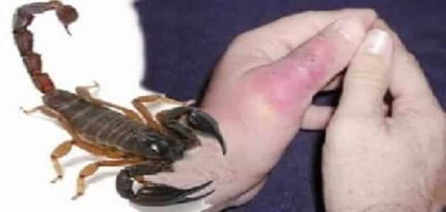 اسرع علاج للدغة العقرب بالكلور في المنزل