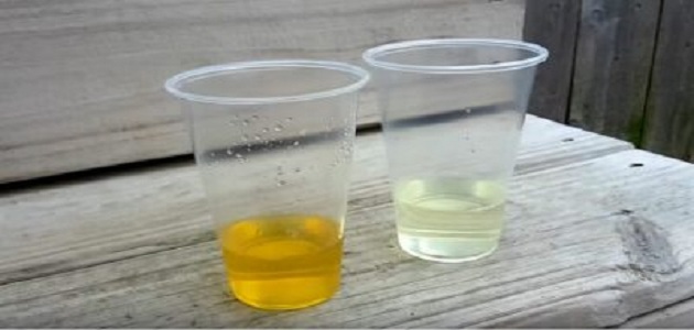 5 طرق منزلية تعلمك بالحمل من لون البول بدون تحليل
