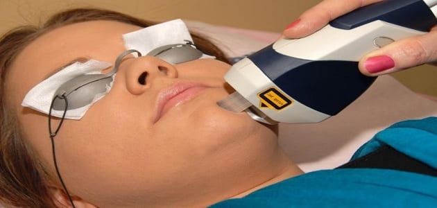اضرار تجارب الفراكشنال ليزر على مسامات الوجه واثاره الجانبية