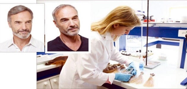 8 ممنوعات لا يمكن المساس لها بعد زراعة الشعر