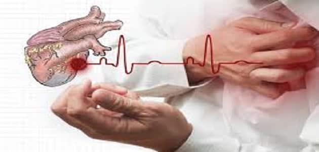 علاج احتشاء عضلة القلب الصامتة
