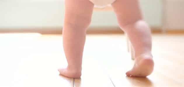 تقوس الساقين