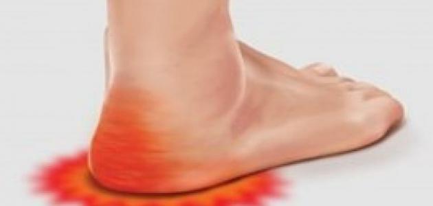 علاج سريع لالم كعب الرجل
