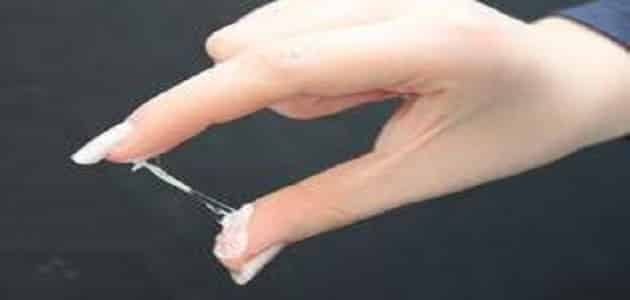افرازات بيضاء سميكة من علامات الحمل