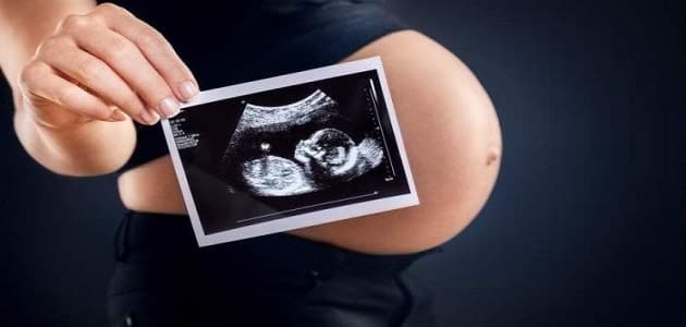 معرفة نوع الجنين من كيس الحمل